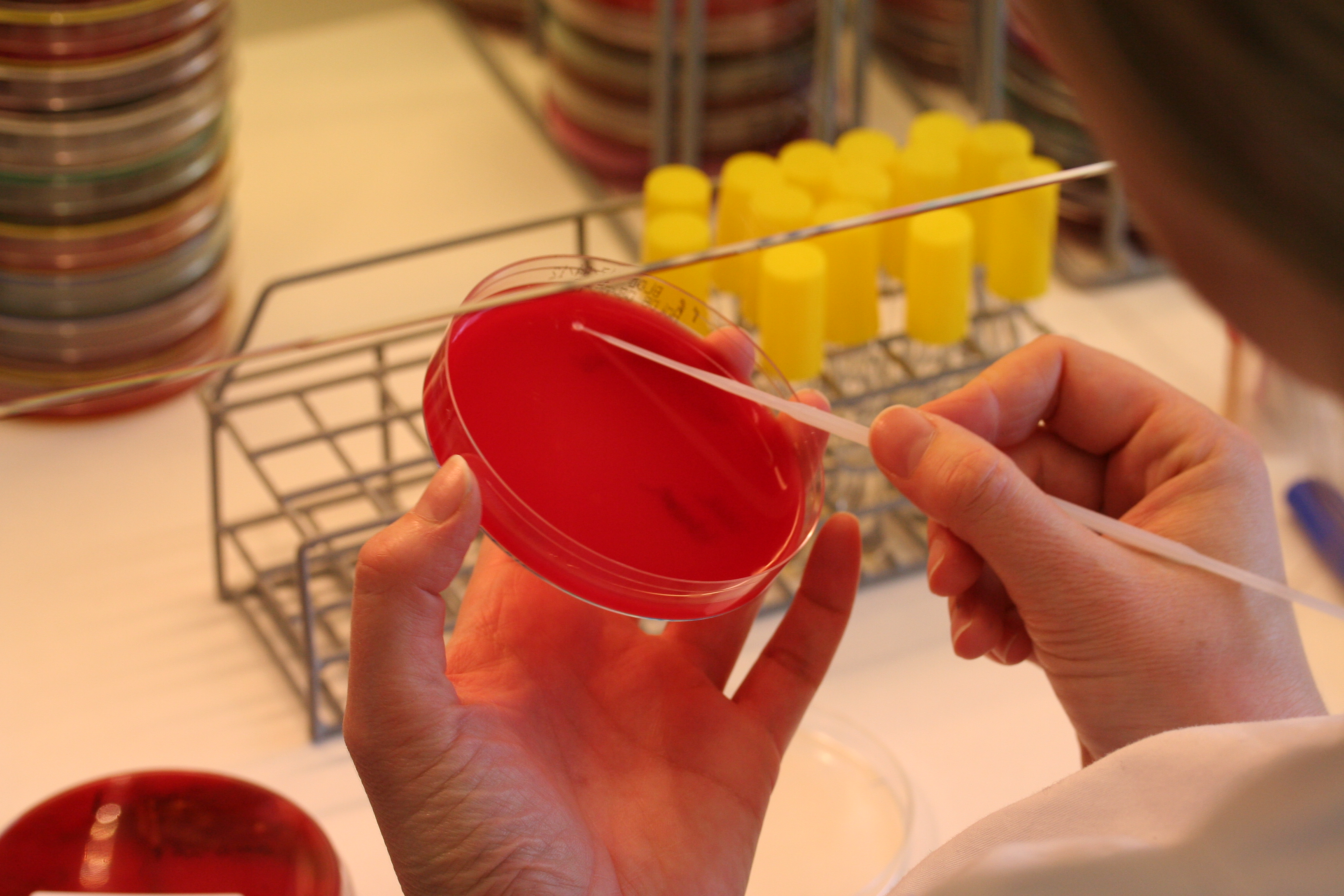 En lab.ansatt som arbeider på mikrobiologisk laboratorium